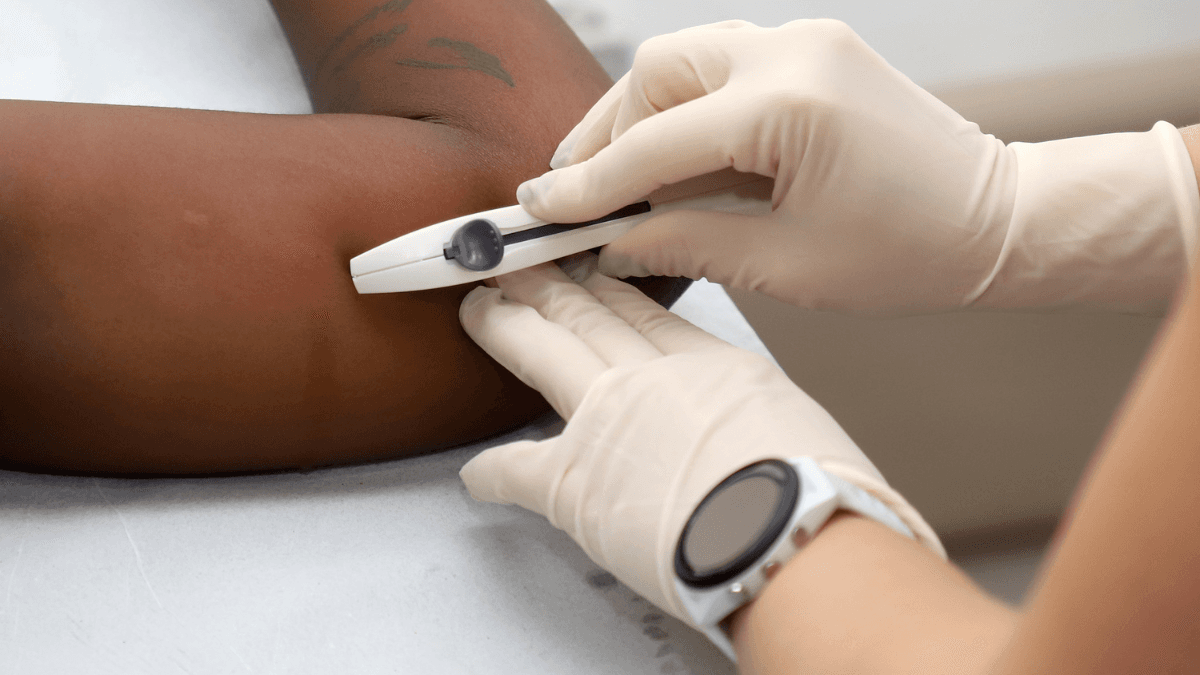 Implante anticoncepcional cresce 500% em Campinas