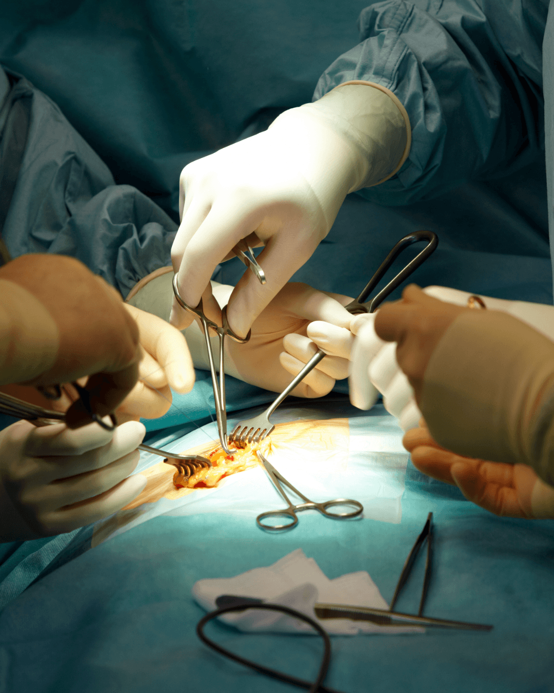Emenda destina R$ 349 mil para cirurgias de endometriose