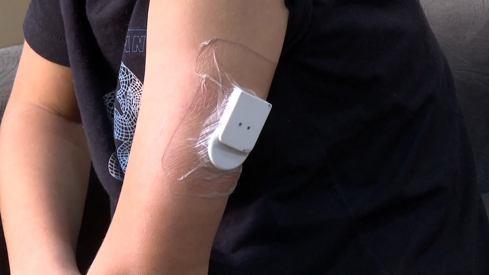 Guarujá entrega sensores de glicose a crianças diabéticas
